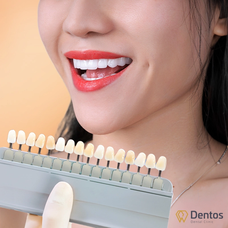 Răng sứ có độ cứng rất cao, thậm chí cứng hơn men răng tự nhiên